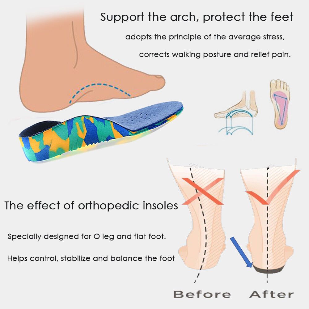 Orthopedic Arch Support Insoles for Kids